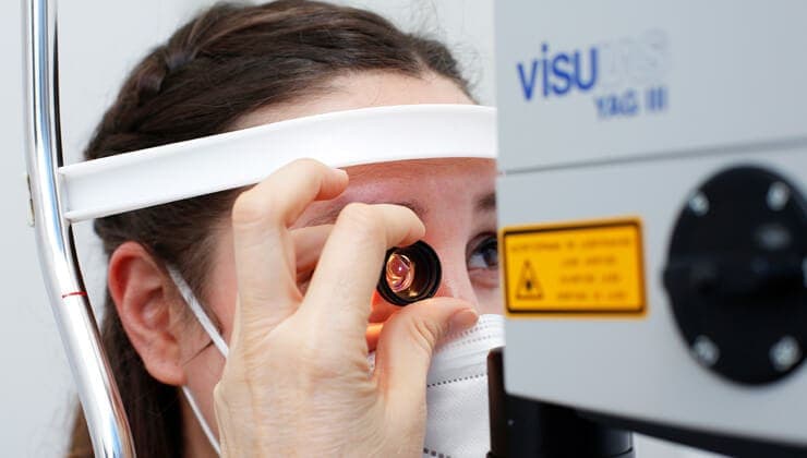 YAG Laser